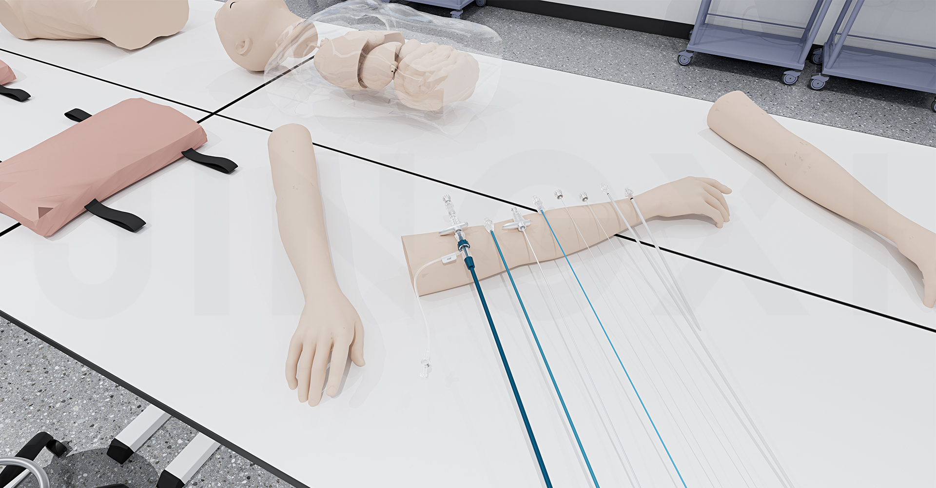 TIPS穿刺套件设计 TIPS穿刺套件设计